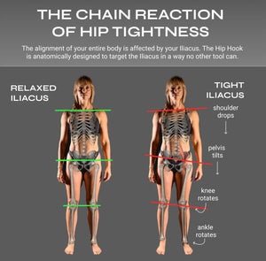 Diagram showing the chain reaction of hip tightness with anatomical illustrations and text.